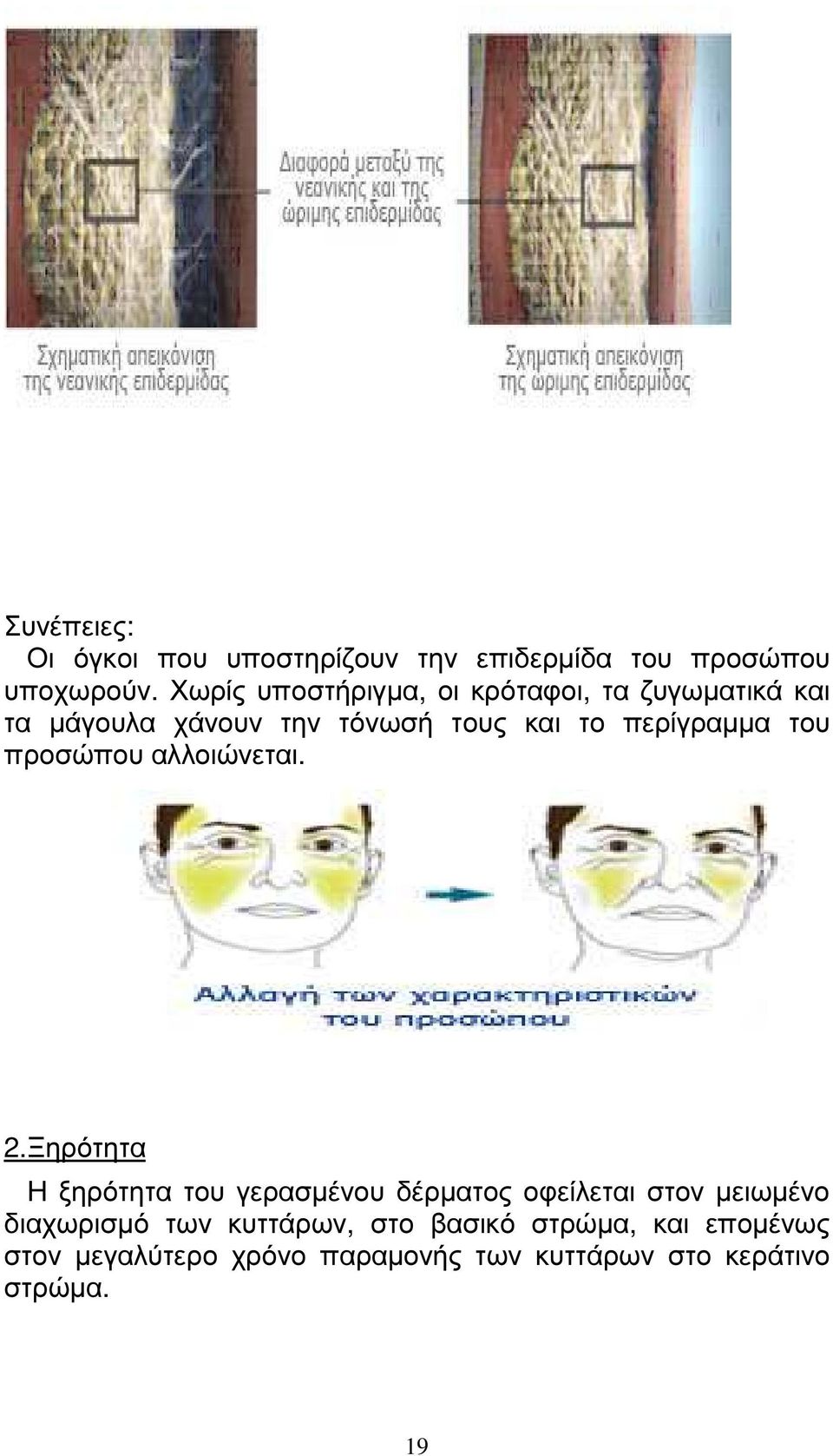 περίγραµµα του προσώπου αλλοιώνεται. 2.