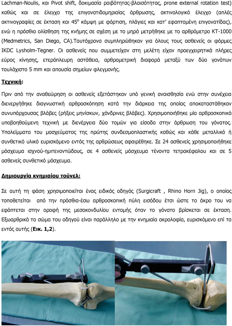 Ταυτόχρονα συµπληρώθηκαν για όλους τους ασθενείς οι φόρµες IKDC Lysholm-Tegner.