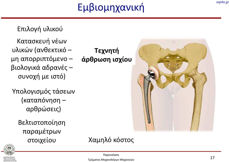 ιστό) Τεχνητή άρθρωση ισχίου Υπολογισμός τάσεων