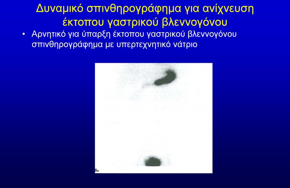 για ύπαρξη έκτοπου γαστρικού