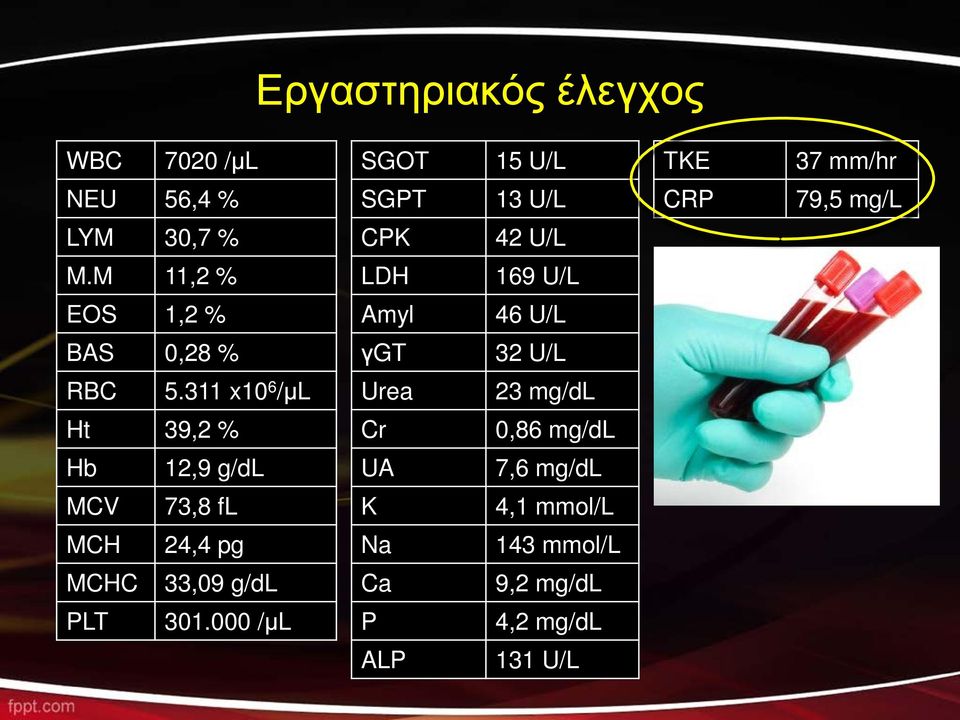 311 x10 6 /μl Urea 23 mg/dl Ht 39,2 % Cr 0,86 mg/dl Hb 12,9 g/dl UA 7,6 mg/dl MCV 73,8 fl K 4,1