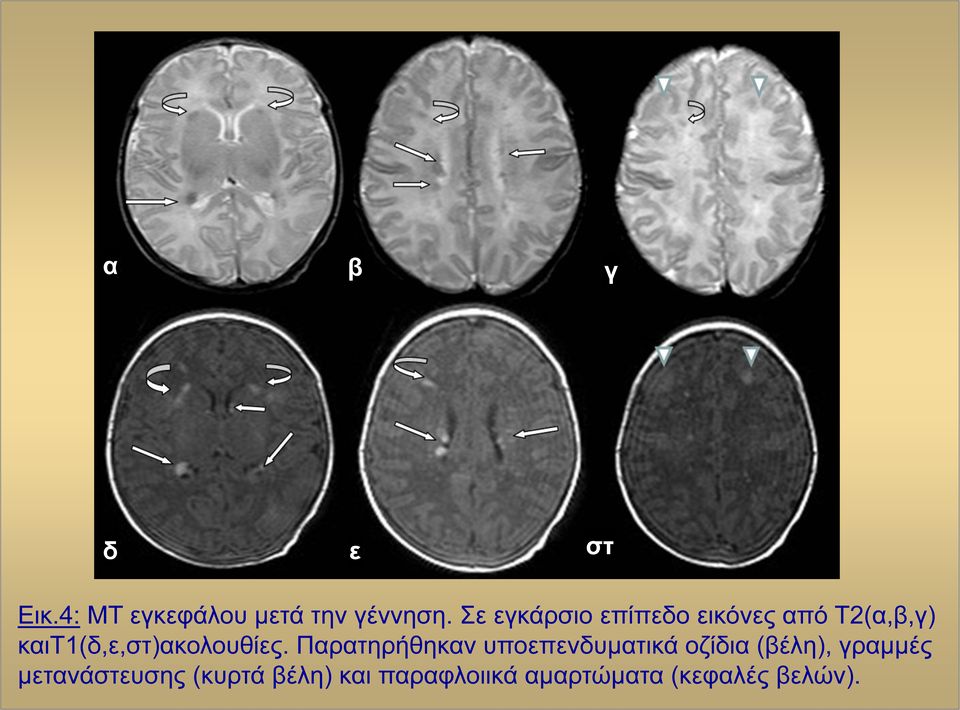 καιτ1(δ,ε,στ)ακολουθίες.