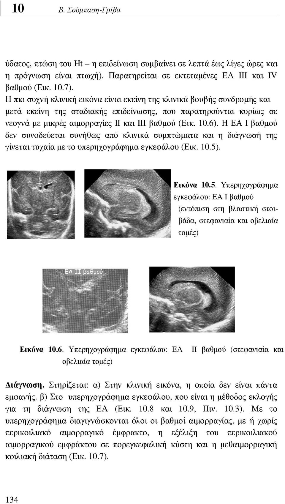 Η ΕΑ I βαθµού δεν συνοδεύεται συνήθως από κλινικά συµπτώµατα και η διάγνωσή της γίνεται τυχαία µε το υπερηχογράφηµα εγκεφάλου (Εικ. 10.5)