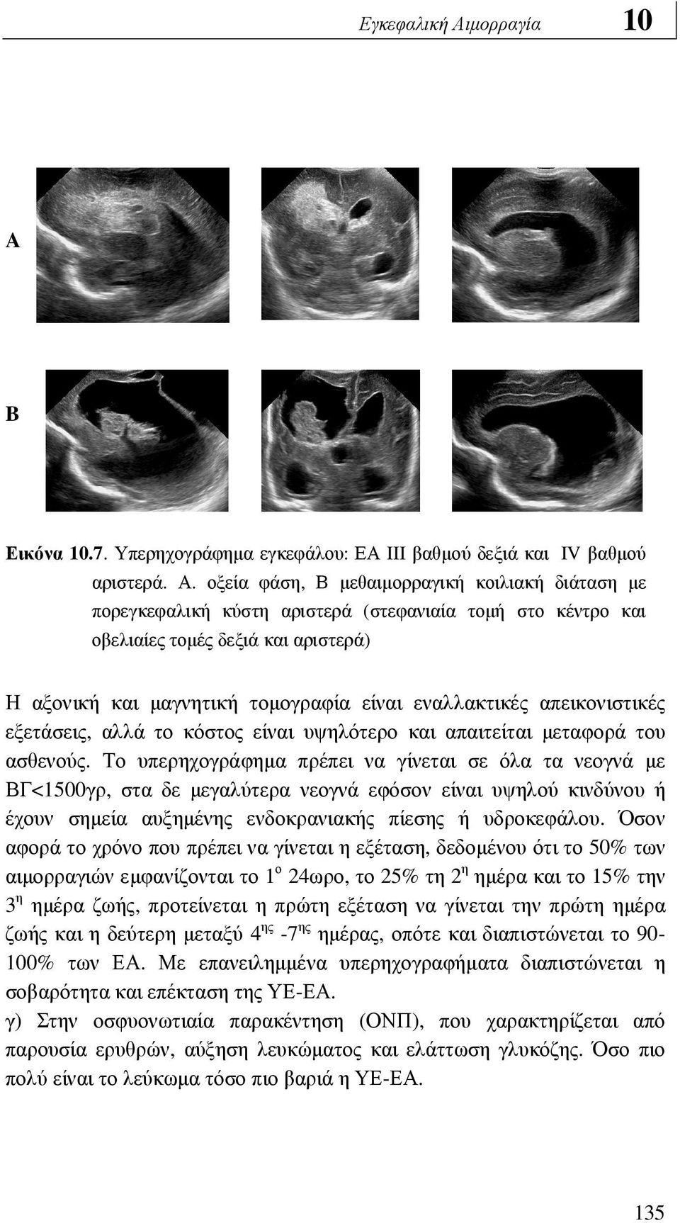 οξεία φάση, Β µεθαιµορραγική κοιλιακή διάταση µε πορεγκεφαλική κύστη αριστερά (στεφανιαία τοµή στο κέντρο και οβελιαίες τοµές δεξιά και αριστερά) Η αξονική και µαγνητική τοµογραφία είναι εναλλακτικές