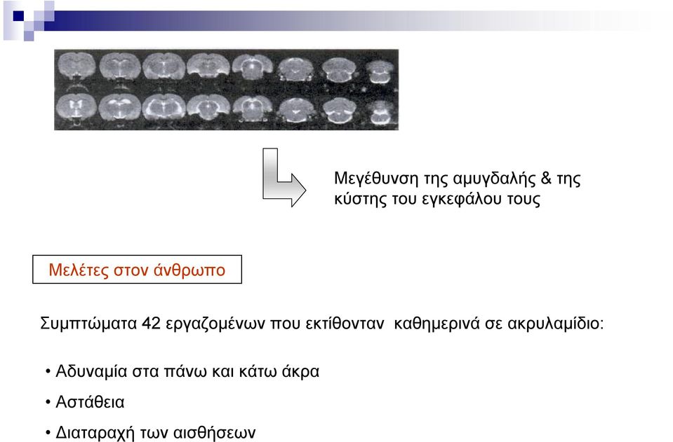 που εκτίθονταν καθημερινά σε ακρυλαμίδιο: Αδυναμία