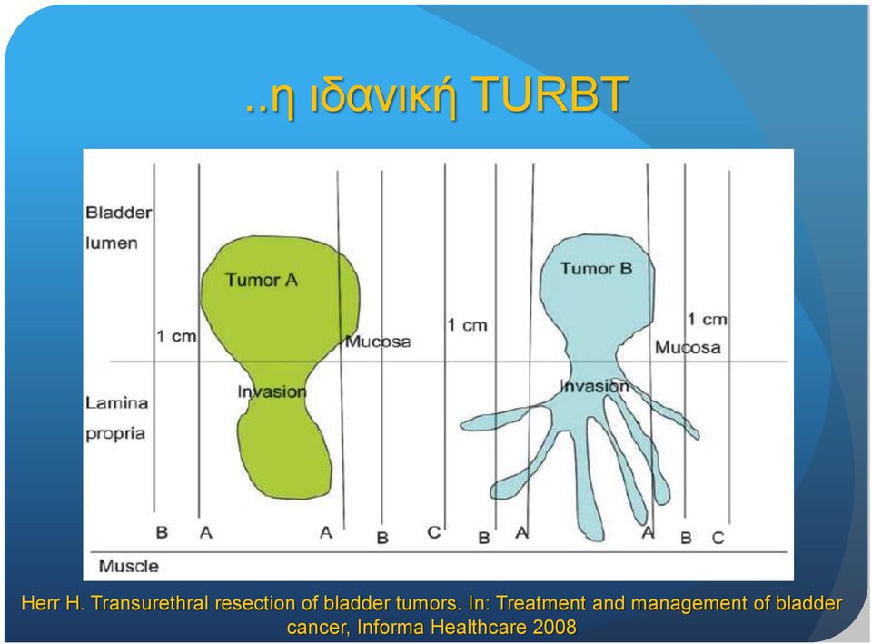 tumors.