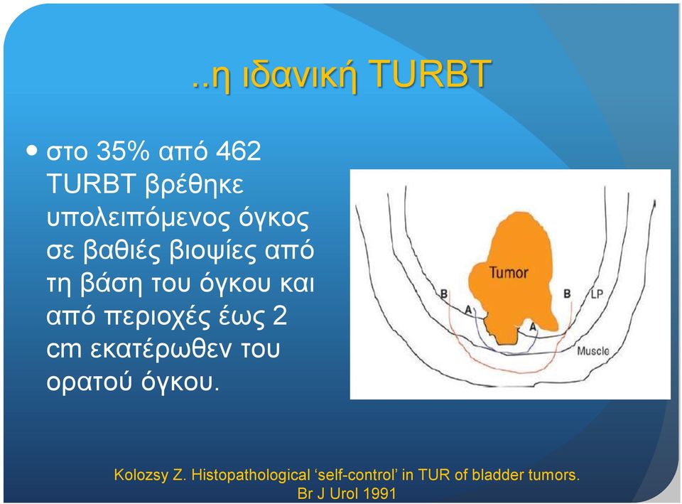 εκατέρωθεν του ορατού όγκου...η ιδανική TURBT Kolozsy Z.