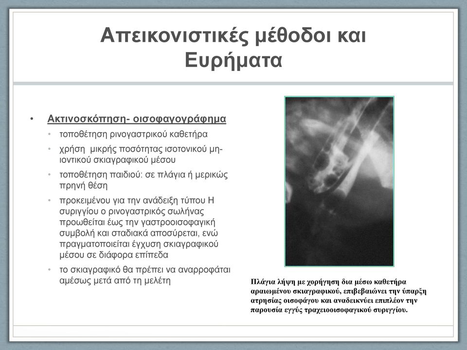 και σταδιακά αποσύρεται, ενώ πραγματοποιείται έγχυση σκιαγραφικού μέσου σε διάφορα επίπεδα το σκιαγραφικό θα πρέπει να αναρροφάται αμέσως μετά από τη μελέτη Πλάγια