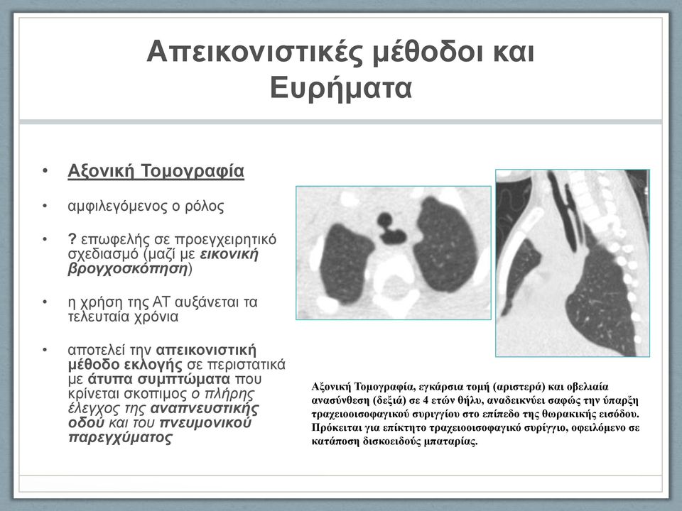 περιστατικά με άτυπα συμπτώματα που κρίνεται σκοπιμος ο πλήρης έλεγχος της αναπνευστικής οδού και του πνευμονικού παρεγχύματος Αξονική Τομογραφία, εγκάρσια τομή