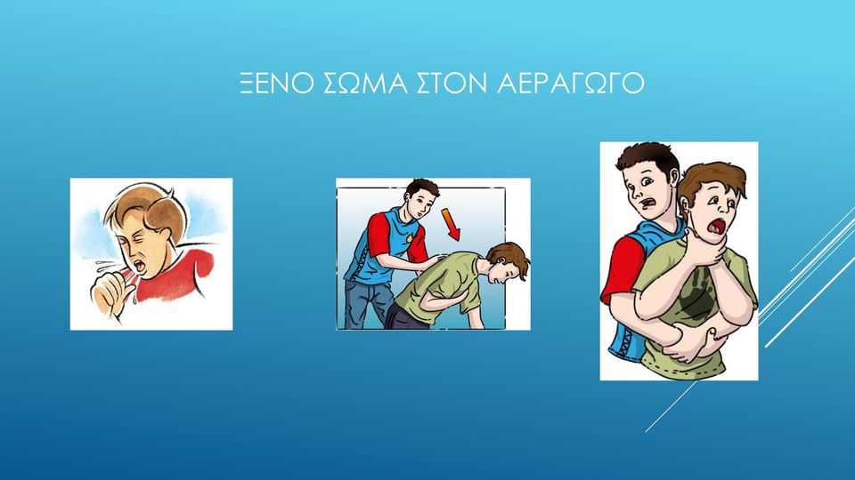 ΑΕΡΑΓΩΓΟ