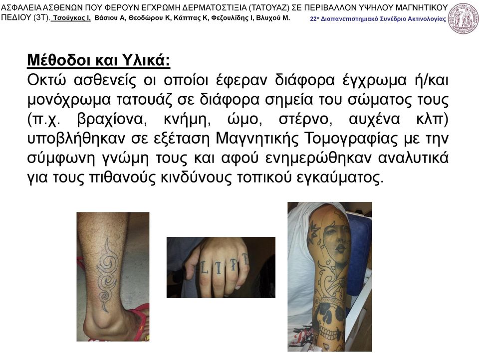 ωμα τατουάζ σε διάφορα σημεία του σώματος τους (π.χ.