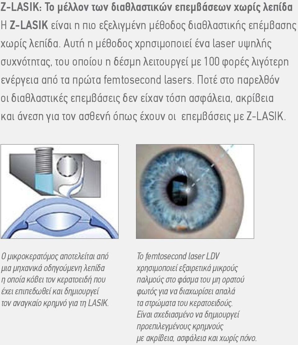 Ποτέ στο παρελθόν οι διαθλαστικές επεμβάσεις δεν είχαν τόση ασφάλεια, ακρίβεια και άνεση για τον ασθενή όπως έχουν οι επεμβάσεις με Z-LASIK.