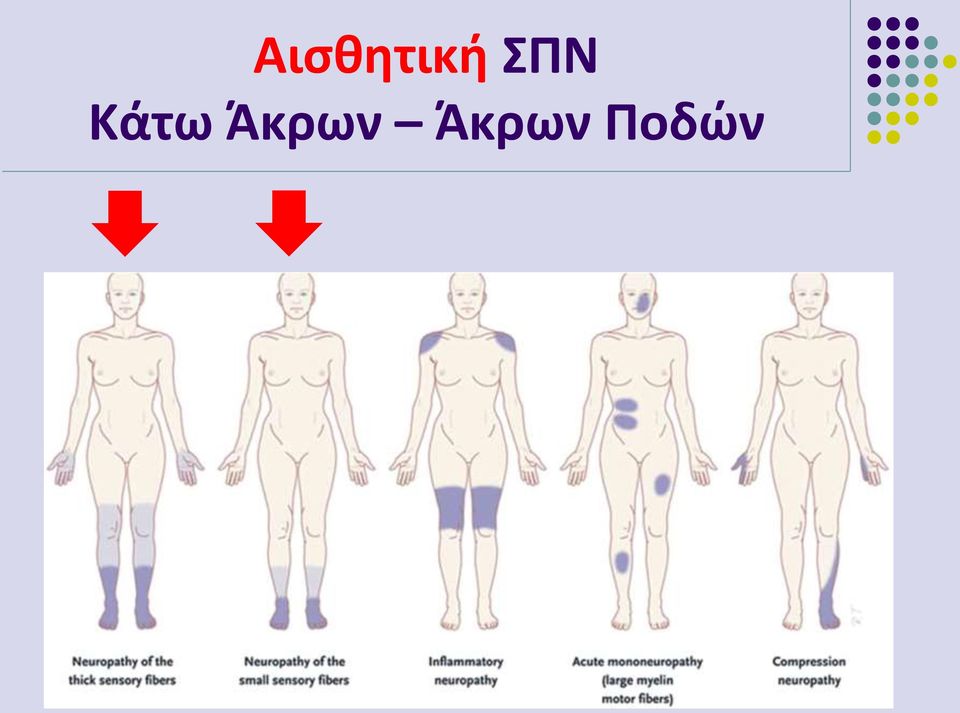 Άκρων