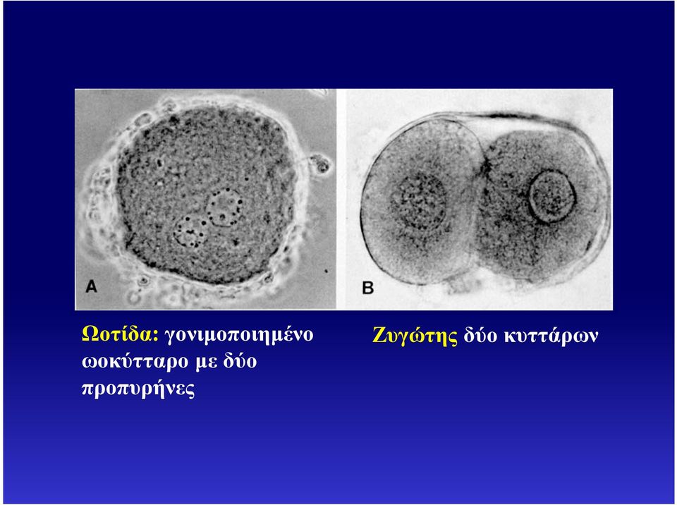 ωοκύτταρο µε δύο