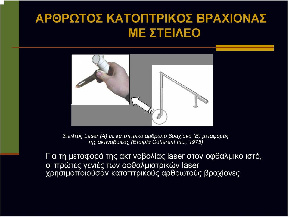 Inc., 1975) Για τη μεταφορά της ακτινοβολίας laser στον οφθαλμικό ιστό, οι