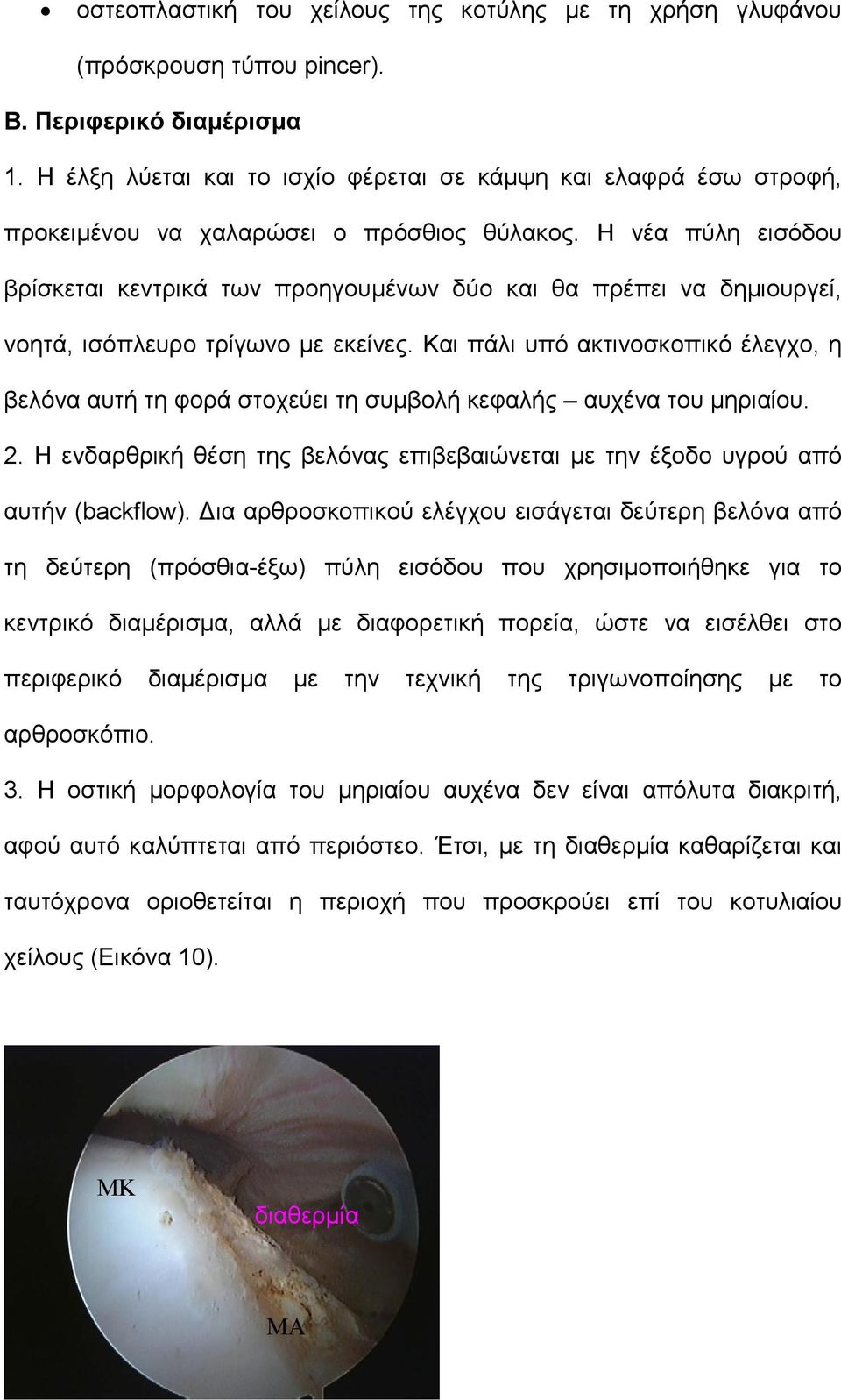 Η νέα πύλη εισόδου βρίσκεται κεντρικά των προηγουμένων δύο και θα πρέπει να δημιουργεί, νοητά, ισόπλευρο τρίγωνο με εκείνες.