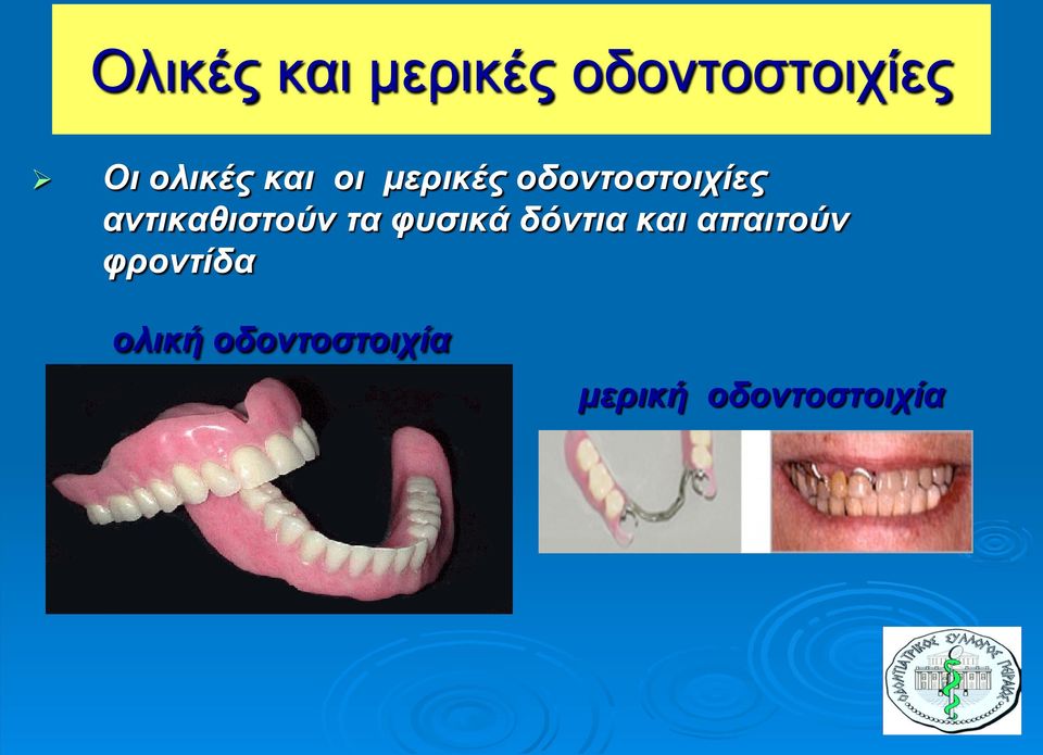 αντικαθιστούν τα φυσικά δόντια και