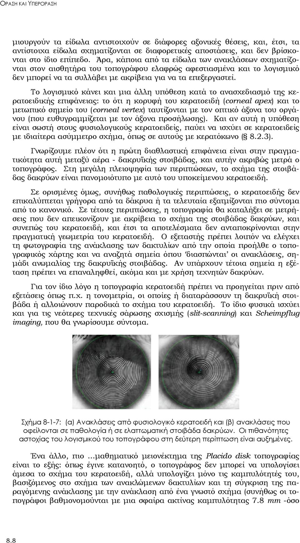 Το λογισμικό κάνει και μια άλλη υπόθεση κατά το ανασχεδιασμό της κερατοειδικής επιφάνειας: το ότι η κορυφή του κερατοειδή (corneal apex) και το μετωπικό σημείο του (corneal vertex) ταυτίζονται με τον