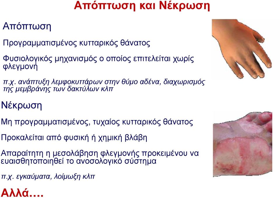 ρίς φλεγμονή π.χ.