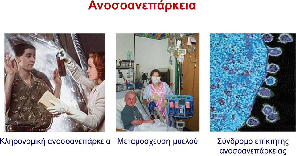 ανοσοανεπάρκεια