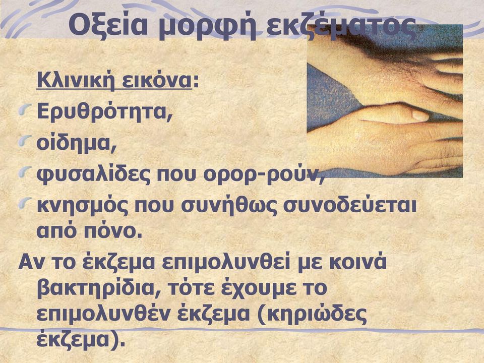 συνοδεύεται από πόνο.