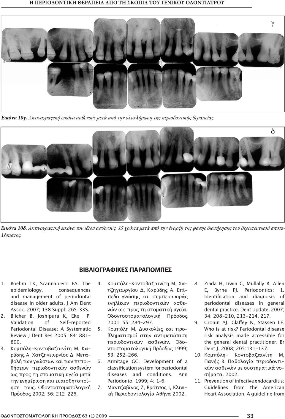 The epidemiology, consequences and management of periodontal disease in older adults. J Am Dent Assoc. 2007; 138 Suppl: 26S-33S. 2. Blicher B, Joshipura K, Eke P.