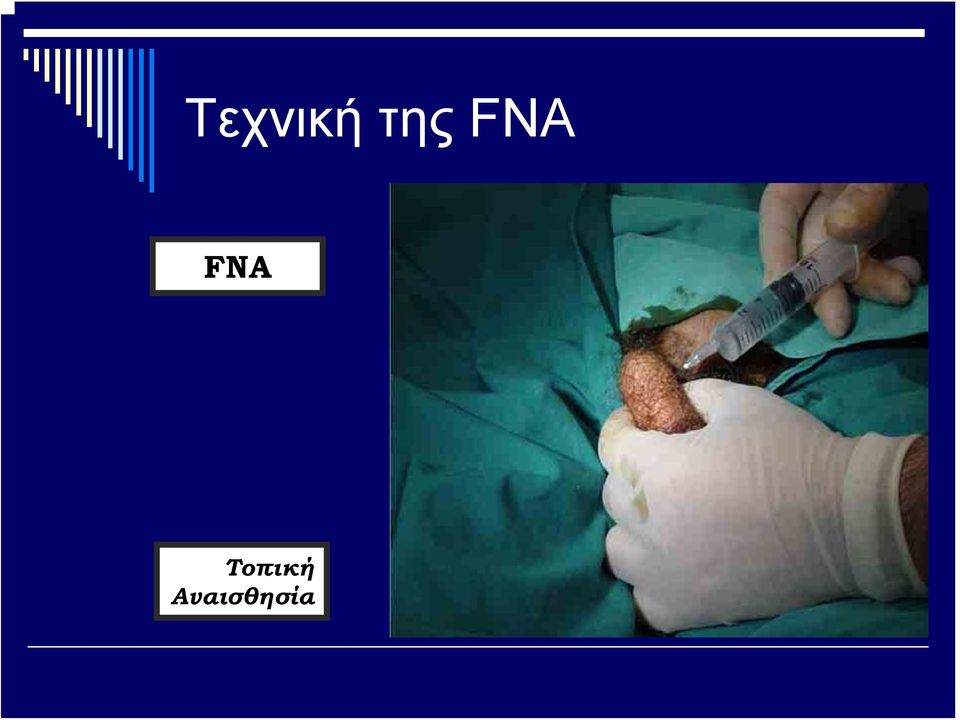 FNA