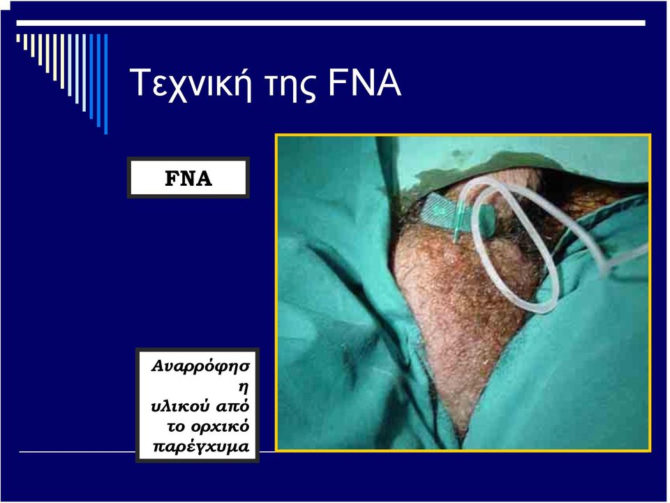 υλικού από το
