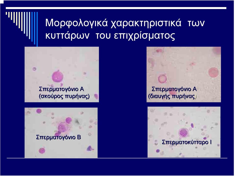 (σκούρος πυρήνας) Σπερματογόνιο Α