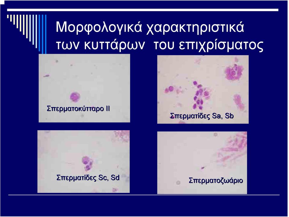 Σπερματοκύτταρο ΙΙ Σπερματίδες