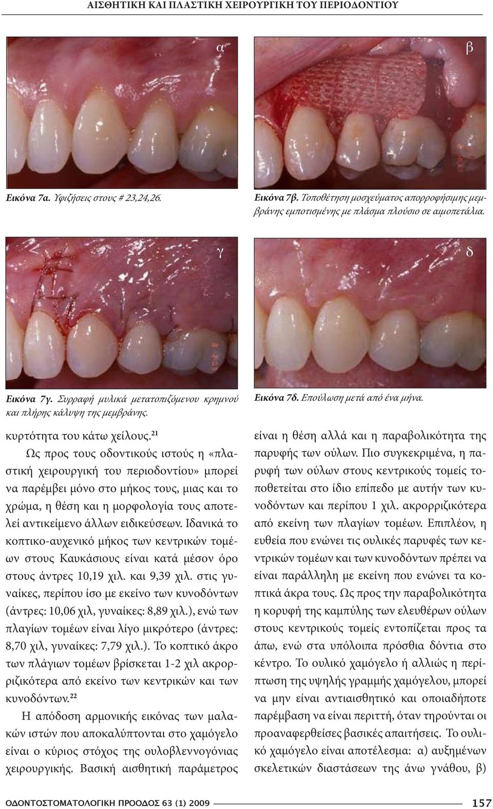 21 Ως προς τους οδοντικούς ιστούς η «πλαστική χειρουργική του περιοδοντίου» μπορεί να παρέμβει μόνο στο μήκος τους, μιας και το χρώμα, η θέση και η μορφολογία τους αποτελεί αντικείμενο άλλων
