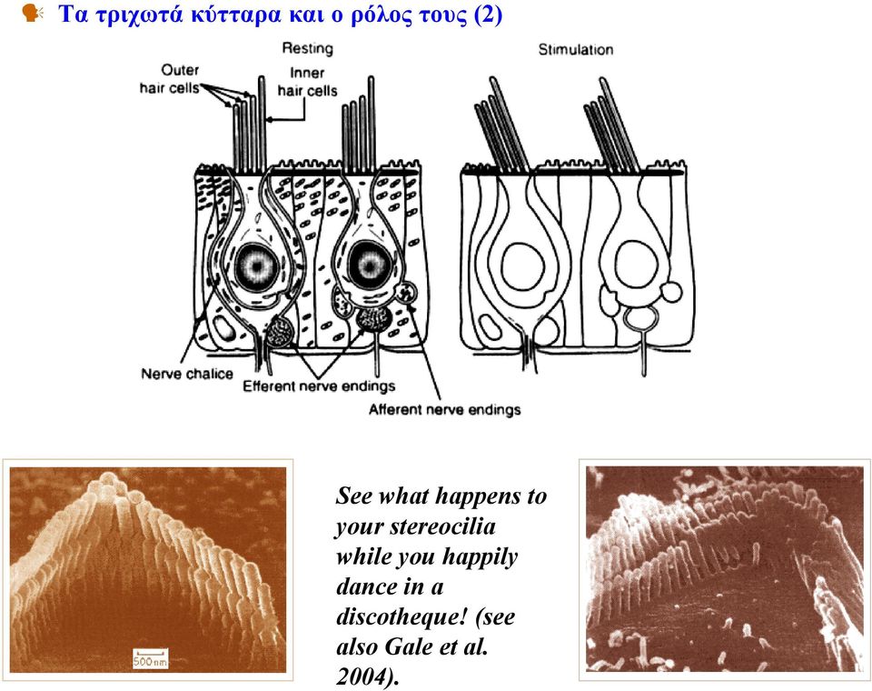 stereocilia while you happily dance