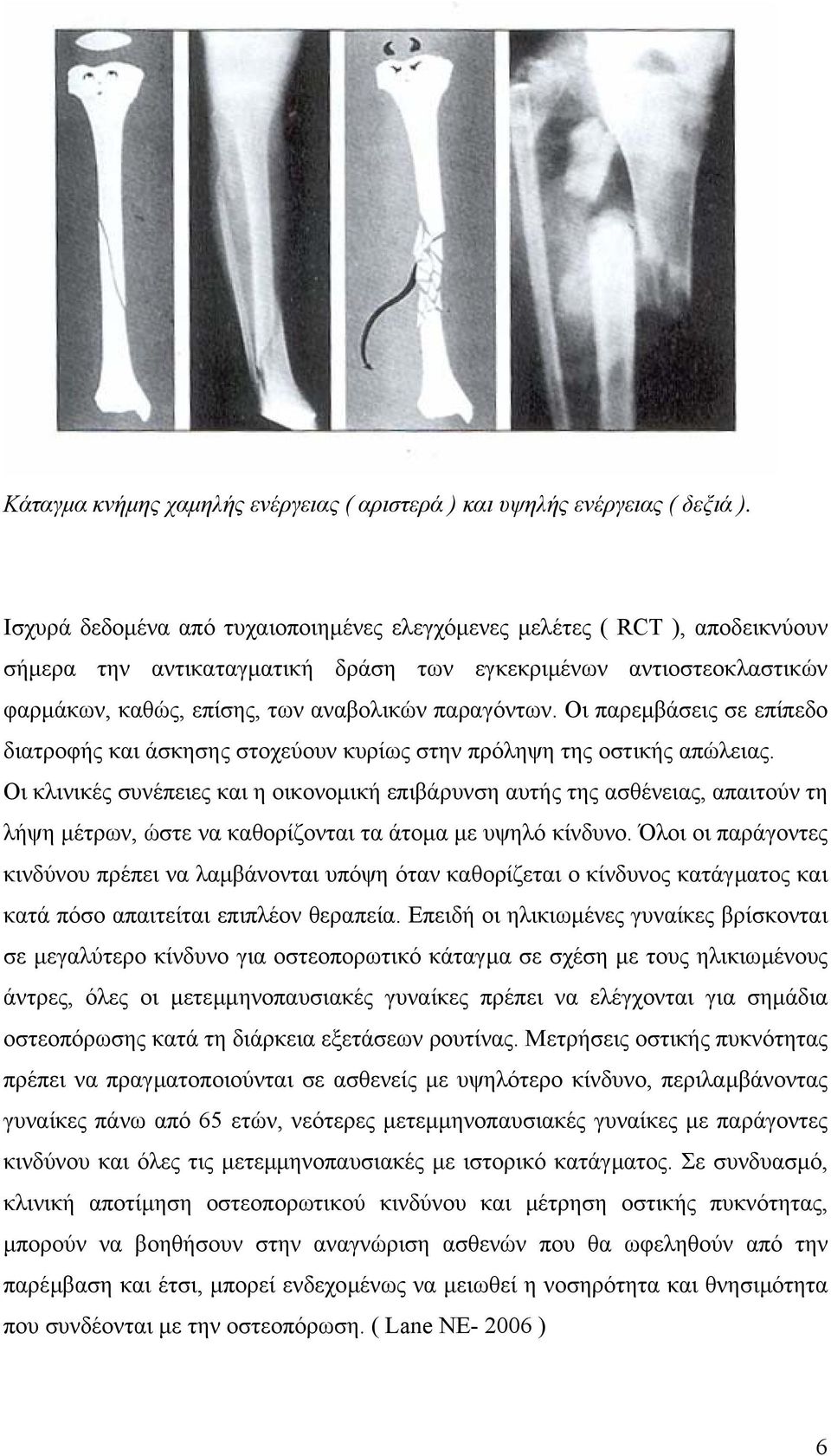 Οι παρεµβάσεις σε επίπεδο διατροφής και άσκησης στοχεύουν κυρίως στην πρόληψη της οστικής απώλειας.