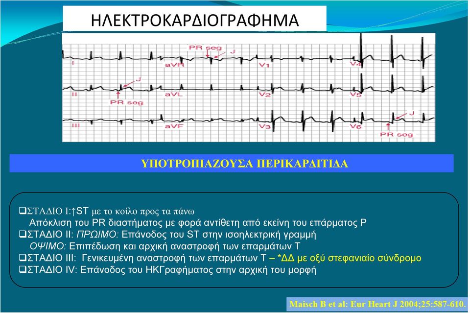 ισοηλεκτρική γραμμή ΟΨΙΜΟ: Επιπέδωση και αρχική αναστροφή των επαρμάτων T ΣΤΑΔΙΟ ΙΙΙ: Γενικευμένη