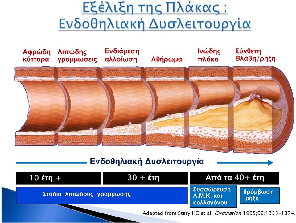 Από τα 40+ έτη Στάδιο λιπώδους γράμμωσης Συσσώρευση Λ.Μ.Κ.