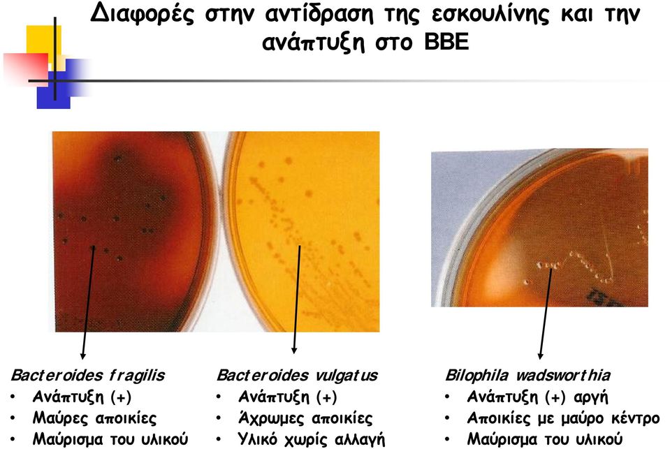 Bacteroides vulgatus Ανάπτυξη (+) Άχρωμες αποικίες Υλικό χωρίς αλλαγή