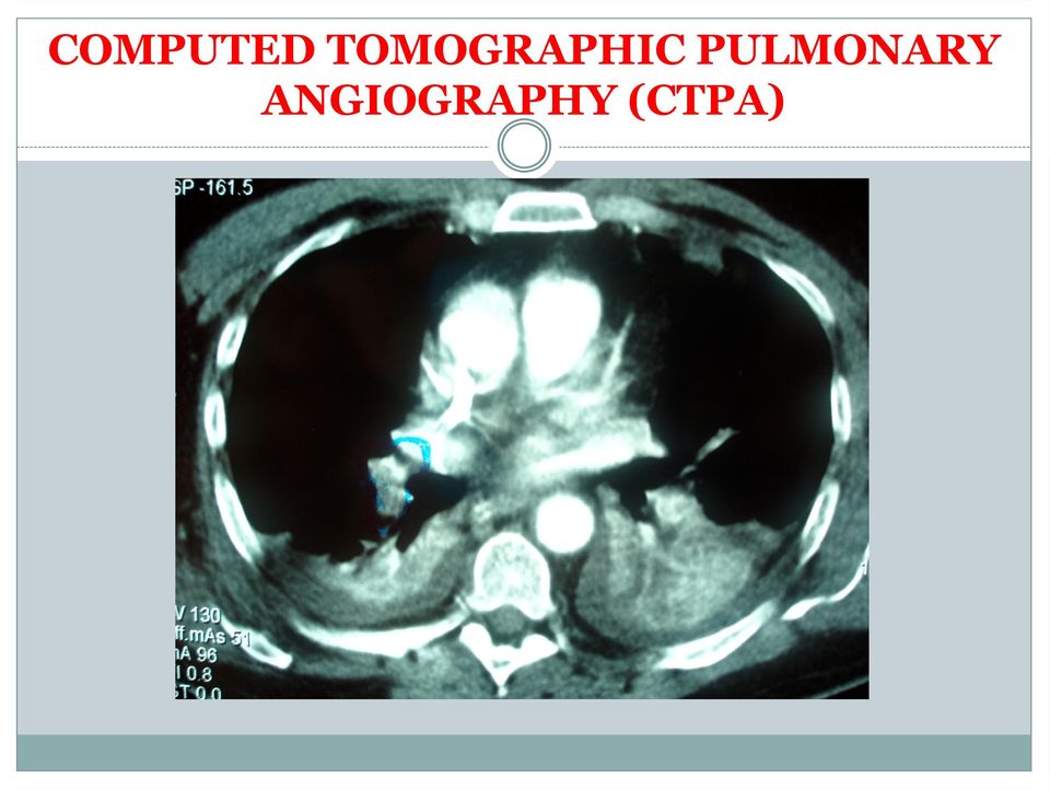 PULMONARY