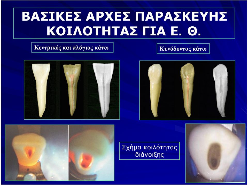 Κεντρικός και πλάγιος κάτω