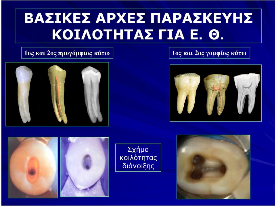 1ος και 2ος προγόμφιος κάτω 1ος