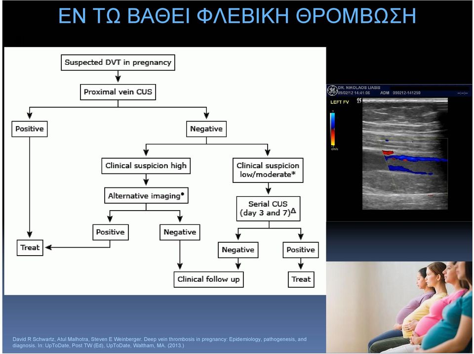 Deep vein thrombosis in pregnancy: Epidemiology,