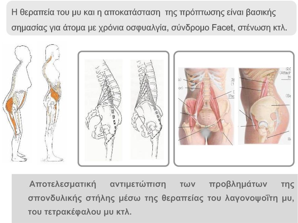 κτλ. Αποτελεσματική αντιμετώπιση των προβλημάτων της σπονδυλικής