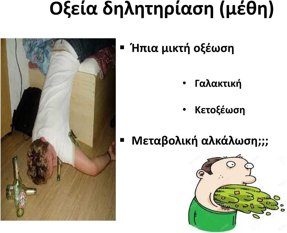 οξέωση Γαλακτική