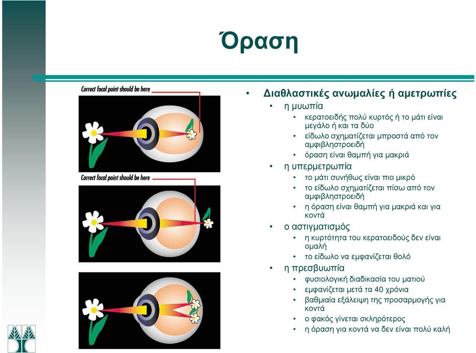 είναι θαµπή για µακριά και για κοντά ο αστιγµατισµός η κυρτότητα του κερατοειδούς δεν είναι οµαλή το είδωλο να εµφανίζεται θολό η πρεσβυωπία φυσιολογική