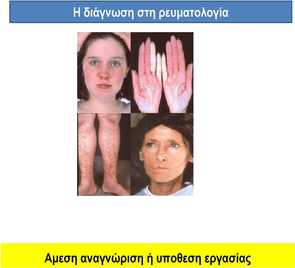 Αμεση