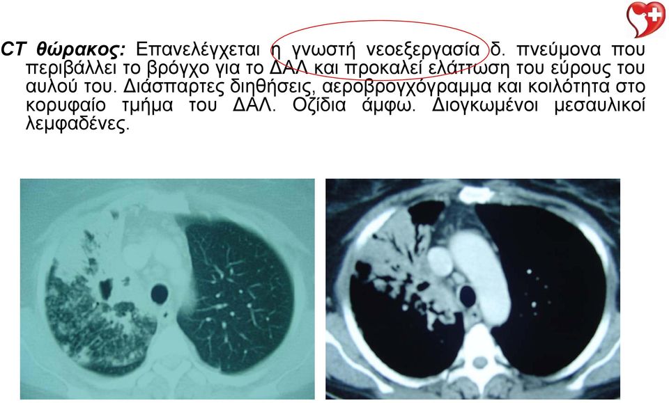 του εύρους του αυλού του.