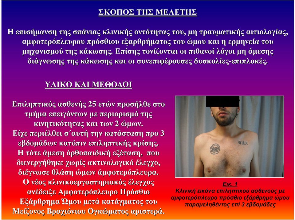 ΥΛΙΚΟ ΚΑΙ ΜΕΘΟ ΟΙ Επιληπτικός ασθενής 25 ετών προσήλθε στο τµήµα επειγόντων µε περιορισµό της κινητικότητας και των 2 ώµων.