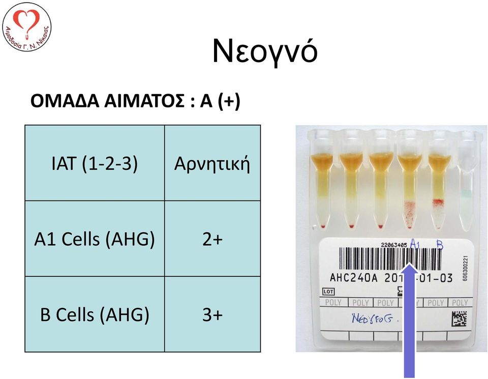 3) Αρνητική A1 Cells