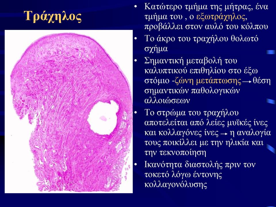 σημαντικών παθολογικών αλλοιώσεων Το στρώμα του τραχήλου αποτελείται από λείες μυϊκές ίνες και κολλαγόνες ίνες