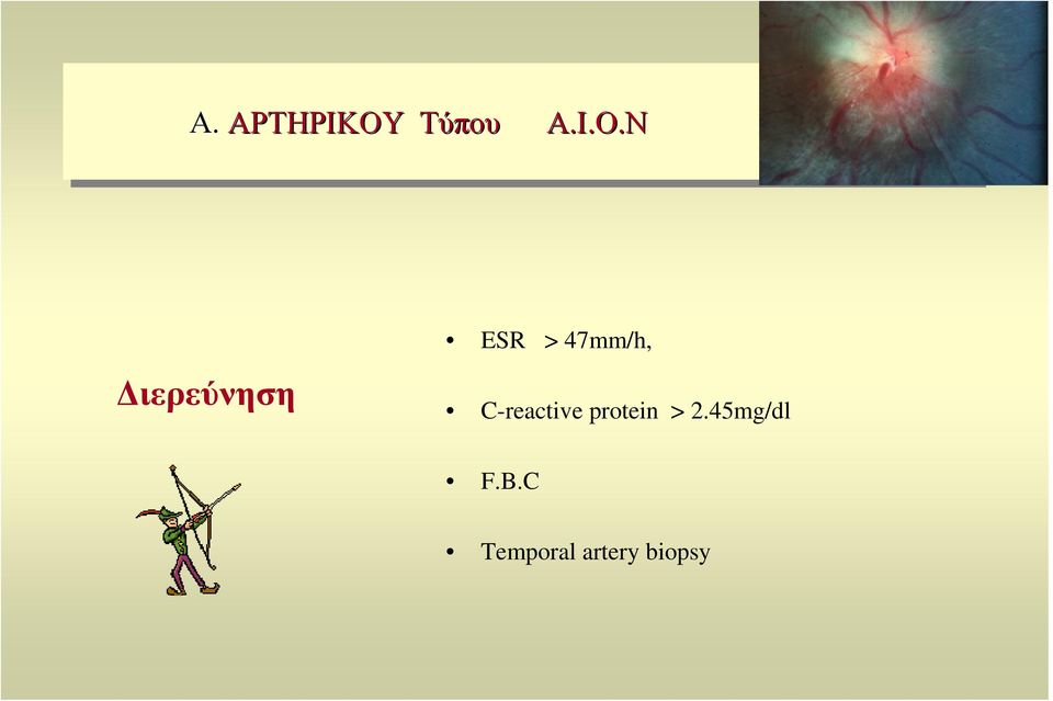 Ν ιερεύνηση ESR > 47mm/h,