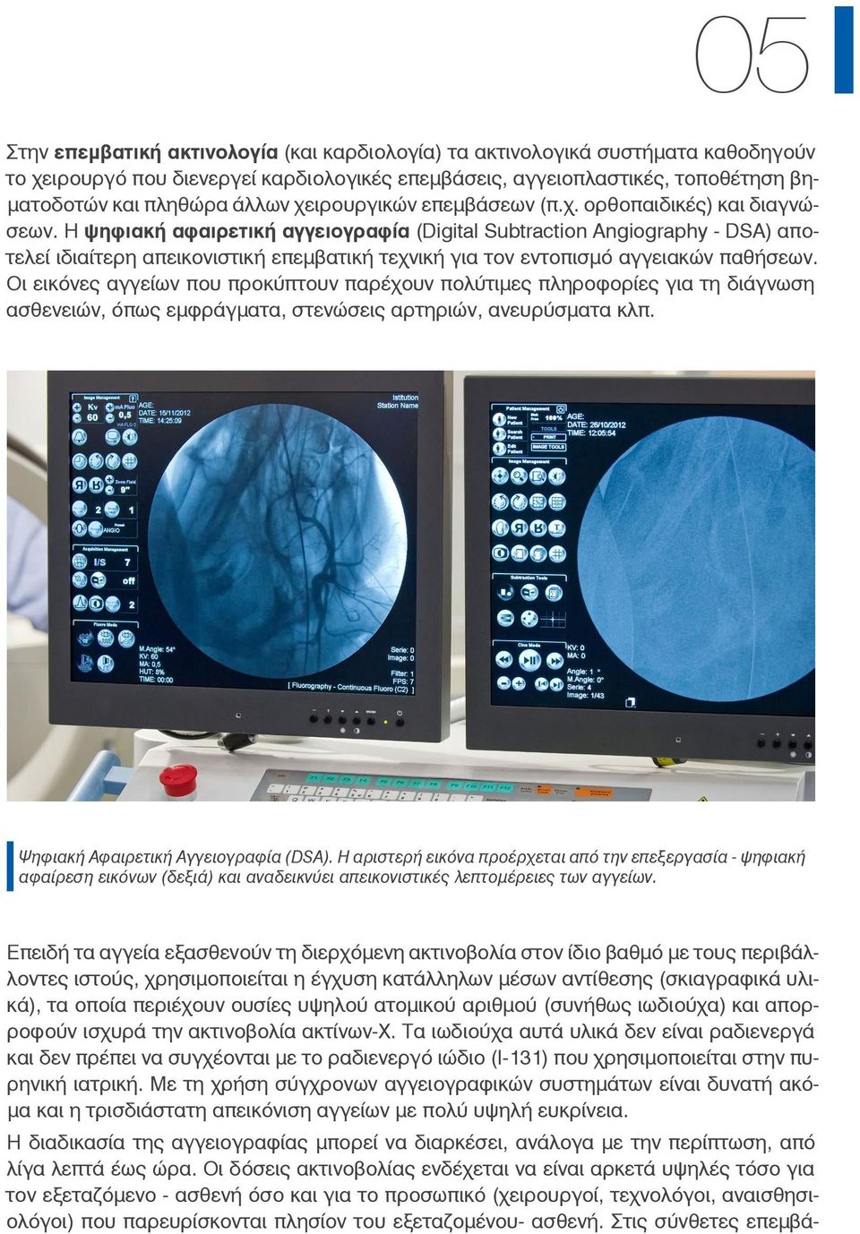 Η ψηφιακή αφαιρετική αγγειογραφία (Digital Subtraction Angiography - DSA) αποτελεί ιδιαίτερη απεικονιστική επεμβατική τεχνική για τον εντοπισμό αγγειακών παθήσεων.